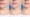Double Chin Injection Testimonial-1