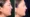 Double Chin Injection Testimonial-2