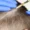 Hair Transplantation 1180x1435 img 3