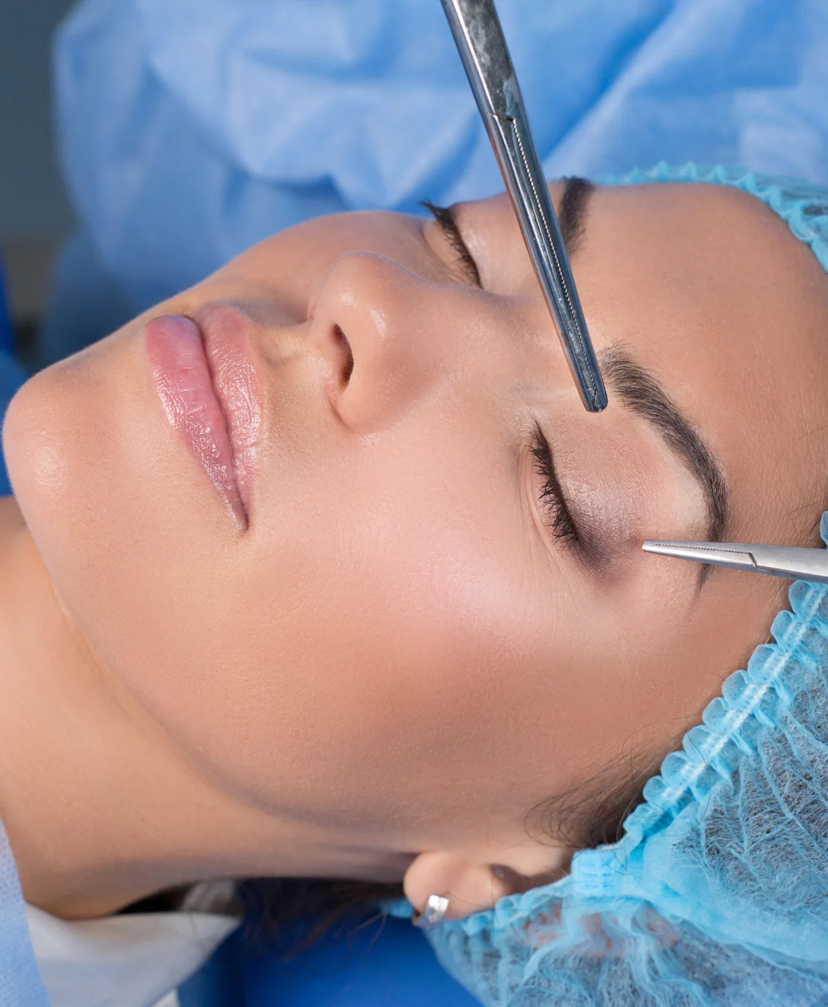 Eyelid Surgery