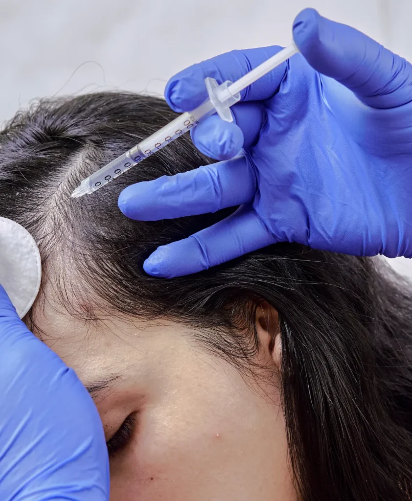 Hair Filler Treatment