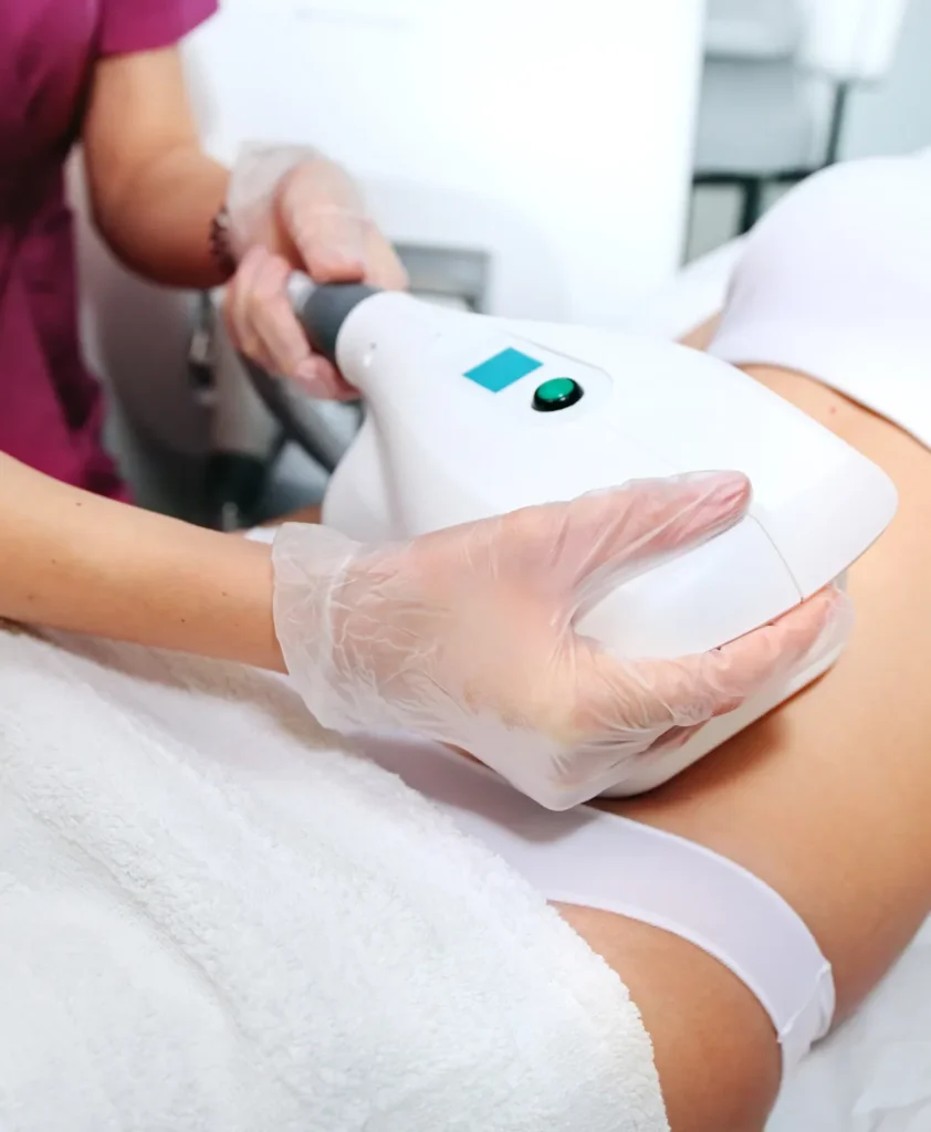 Fotona TightSculpting