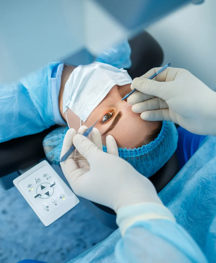 Smooth Eye Laser