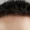 Forhead Lift