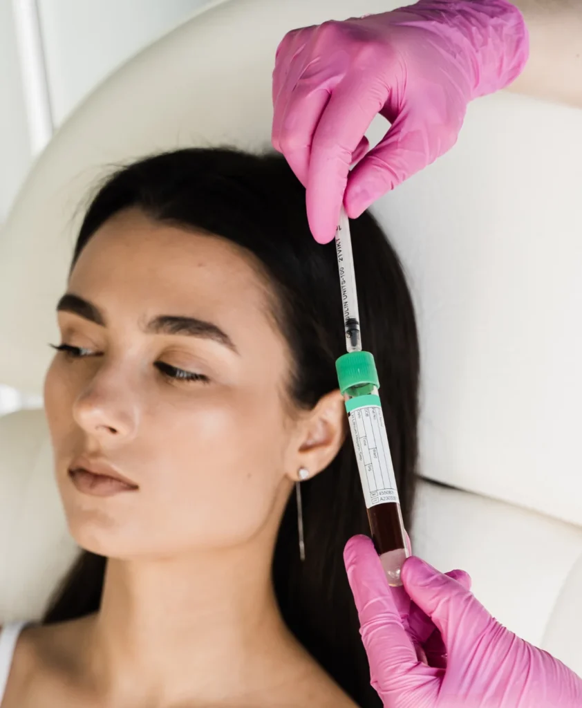 Platelet Rich Plasma