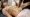 Fotona TightSculpting