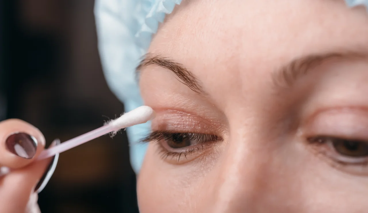 Eyelid Surgery
