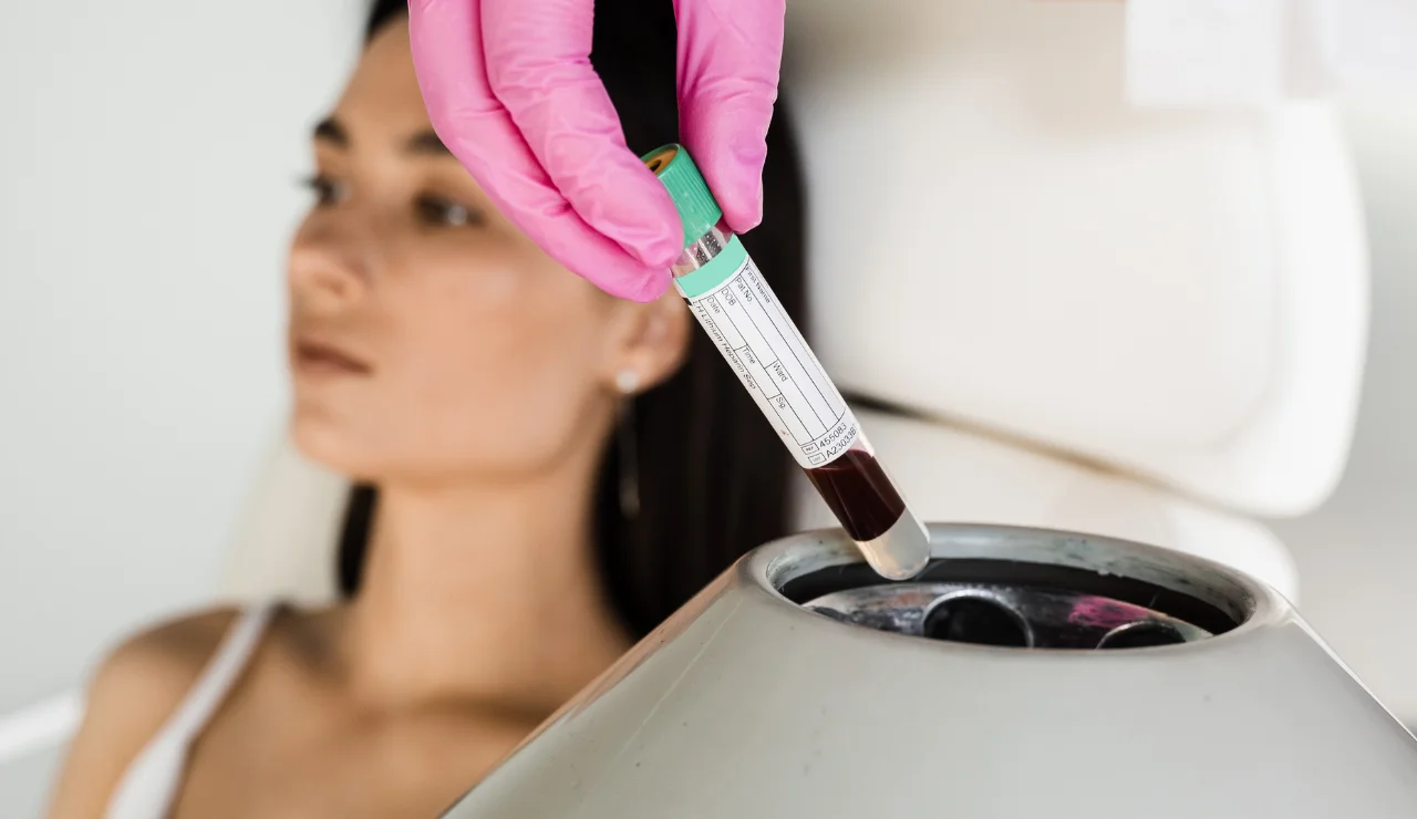 Platelet Rich Plasma