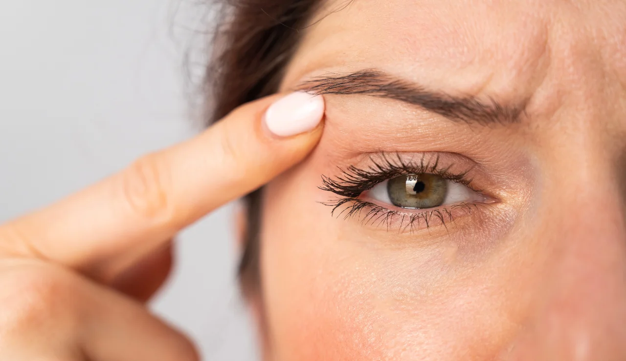 Eyelid Surgery