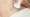 Fotona TightSculpting