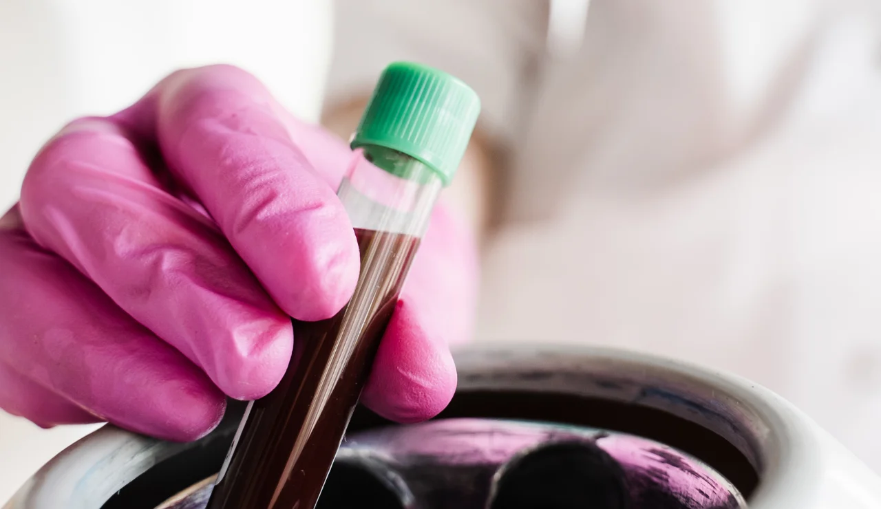 Platelet Rich Plasma
