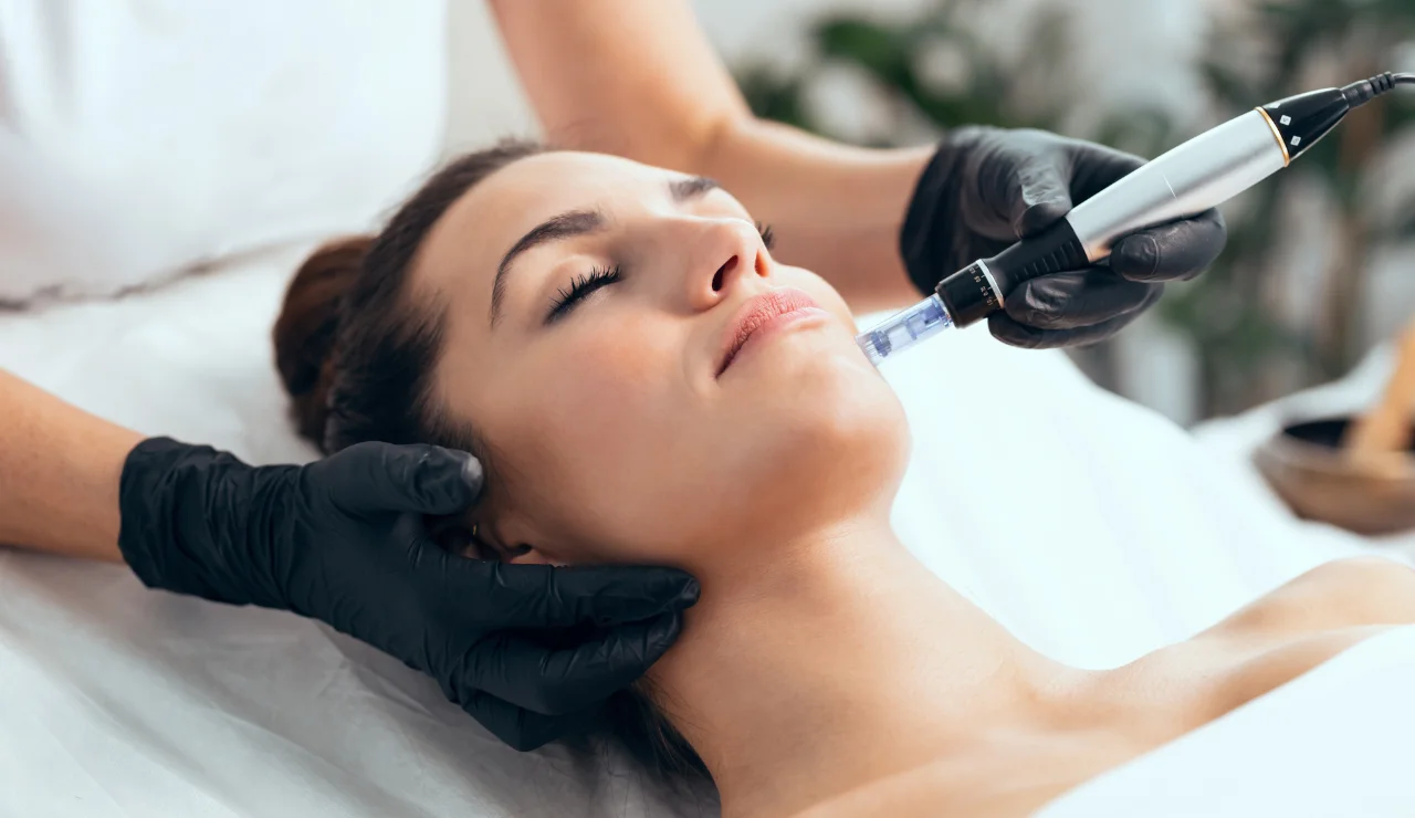 Profound Microneedling