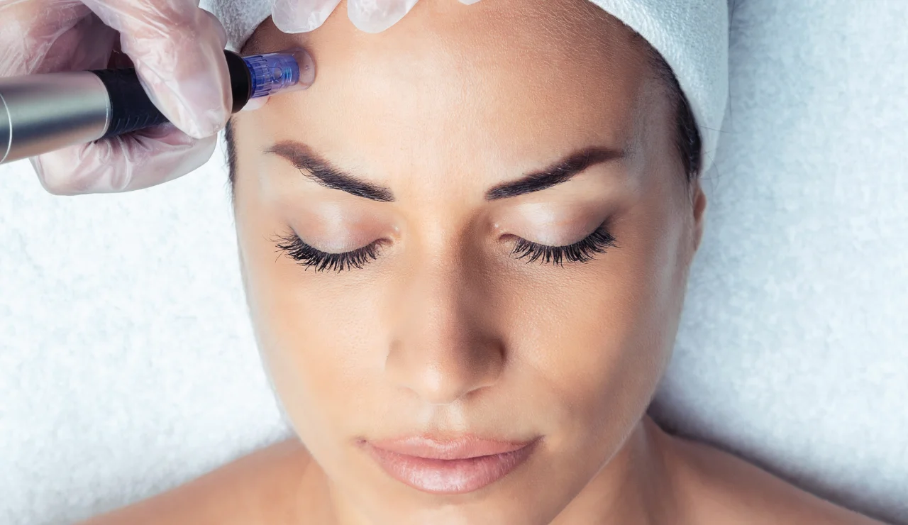 Profound Microneedling