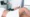 Fotona TightSculpting