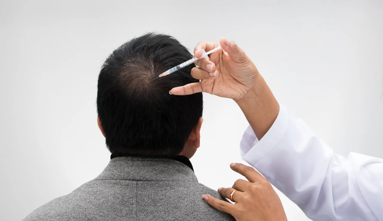 Hair Filler Treatment