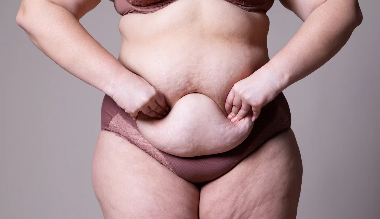 Tummy Tuck testimonial-1