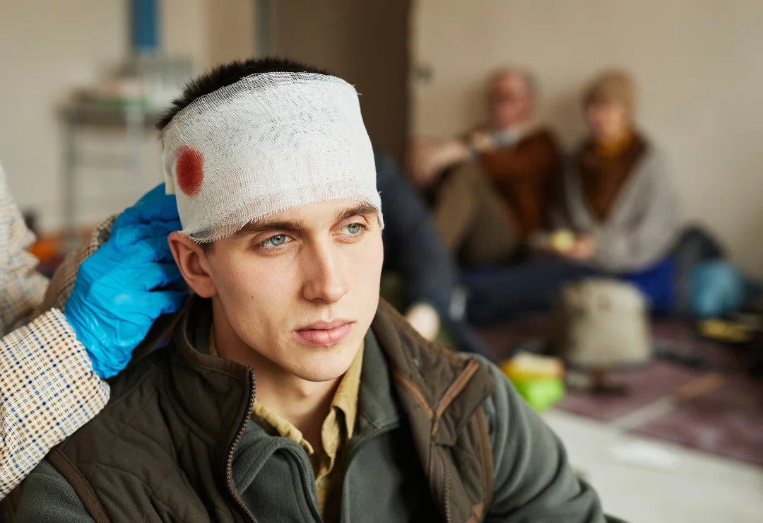 Minor Head Injuries - img