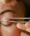 Blepharoplasty Procedure 1180x1435 img