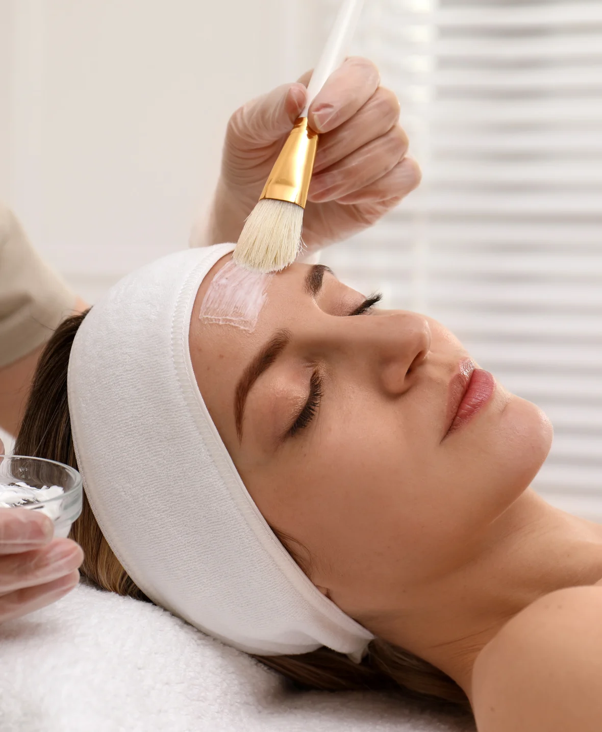 Chemical Peel Procedure