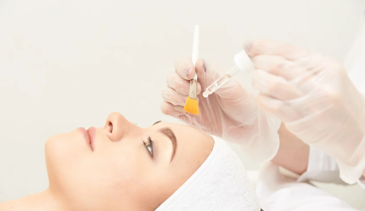 Chemical Peel Procedure - Testimonial