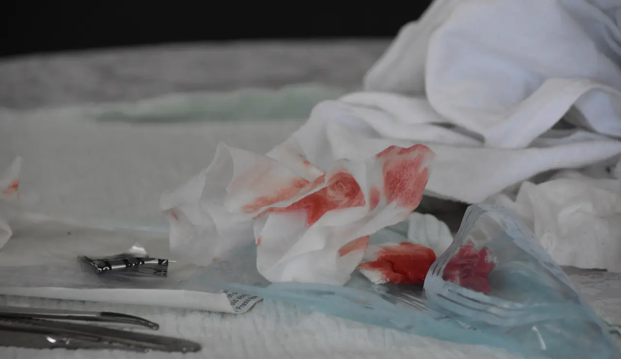 Circumcision - Testimonial