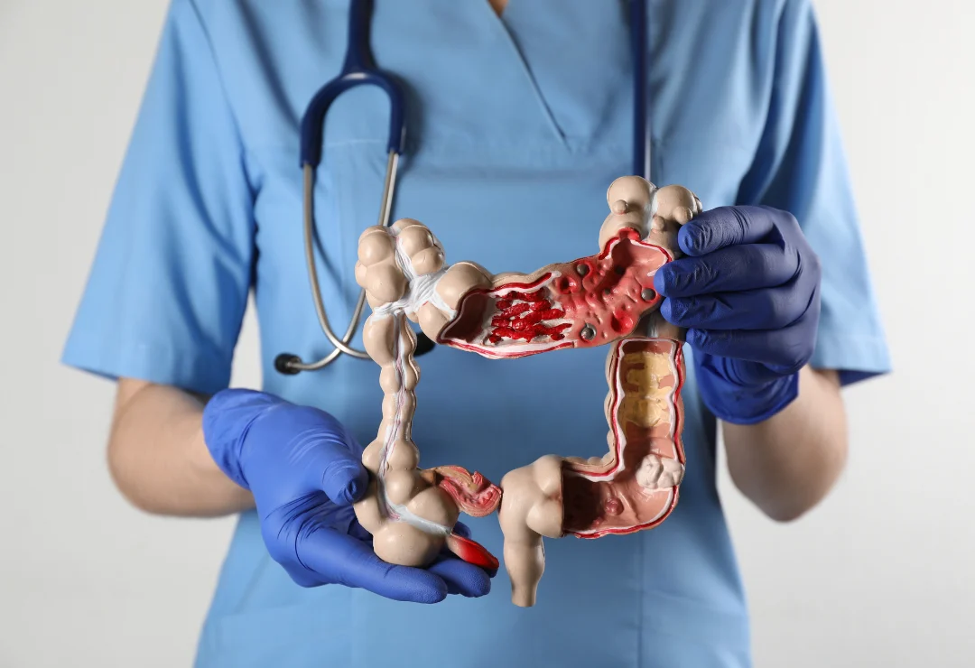 Colon and Rectal Surgery- Thumbnail