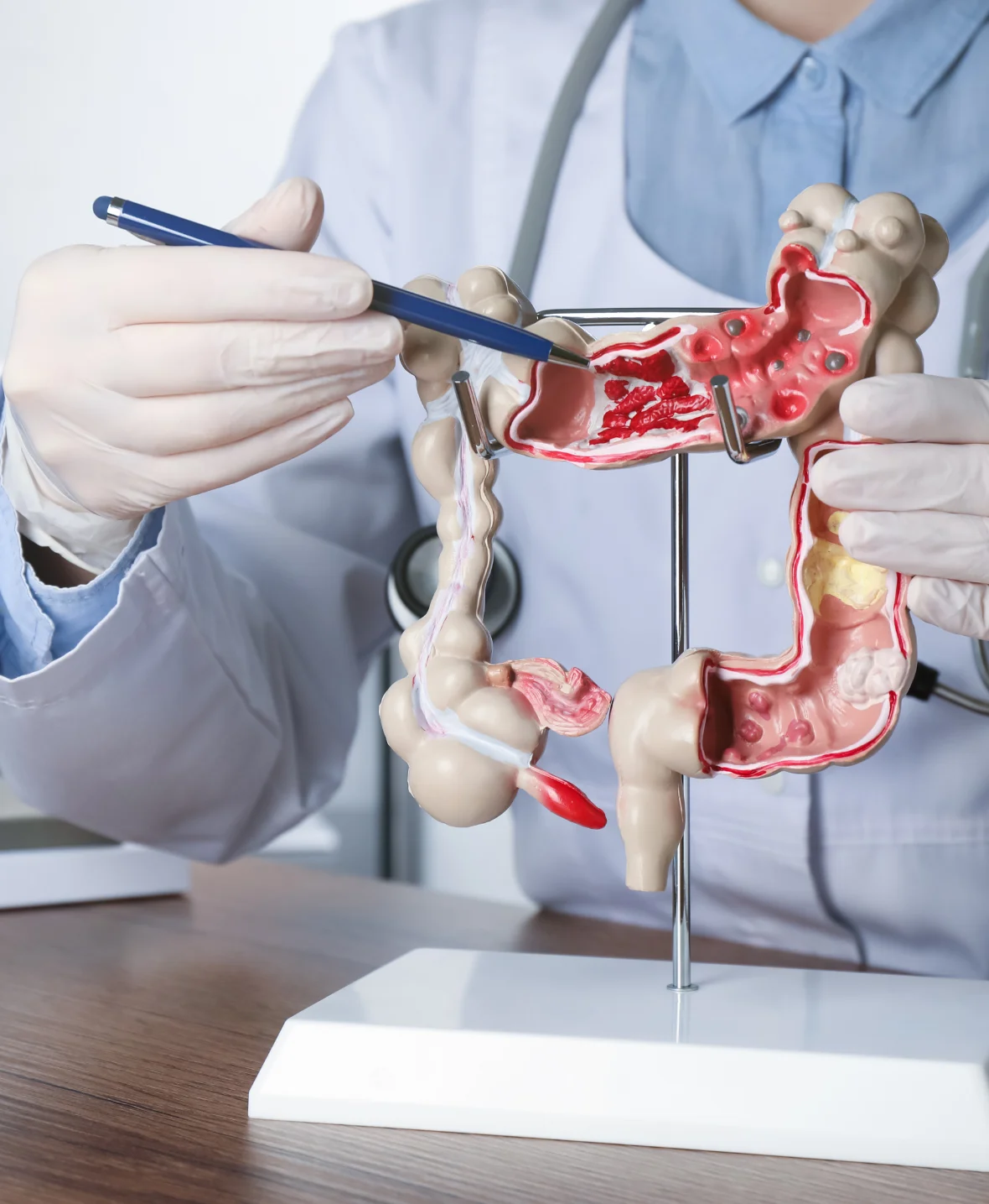 Colon and Rectal Surgery