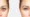 Gynecomastia - Blepharoplasty Testimonial