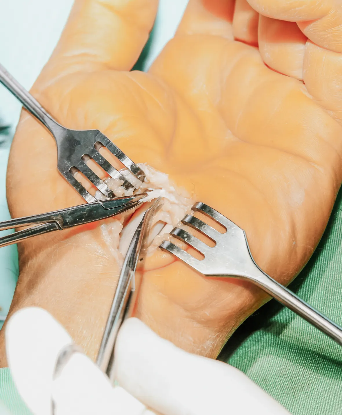 Hand Surgery 1180x1435 img