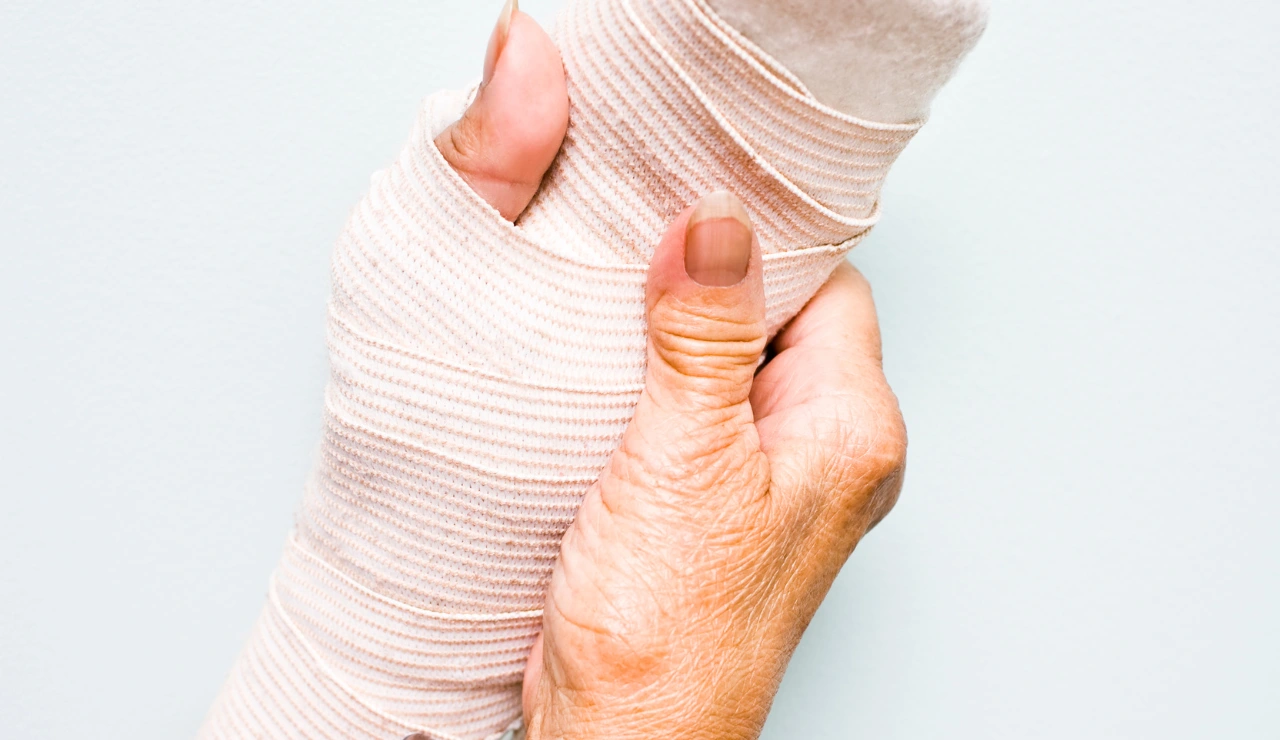 Hand Surgery Testimonial