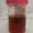 Hematuria (Blood in Urine)