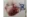 Hematuria (Blood in Urine)