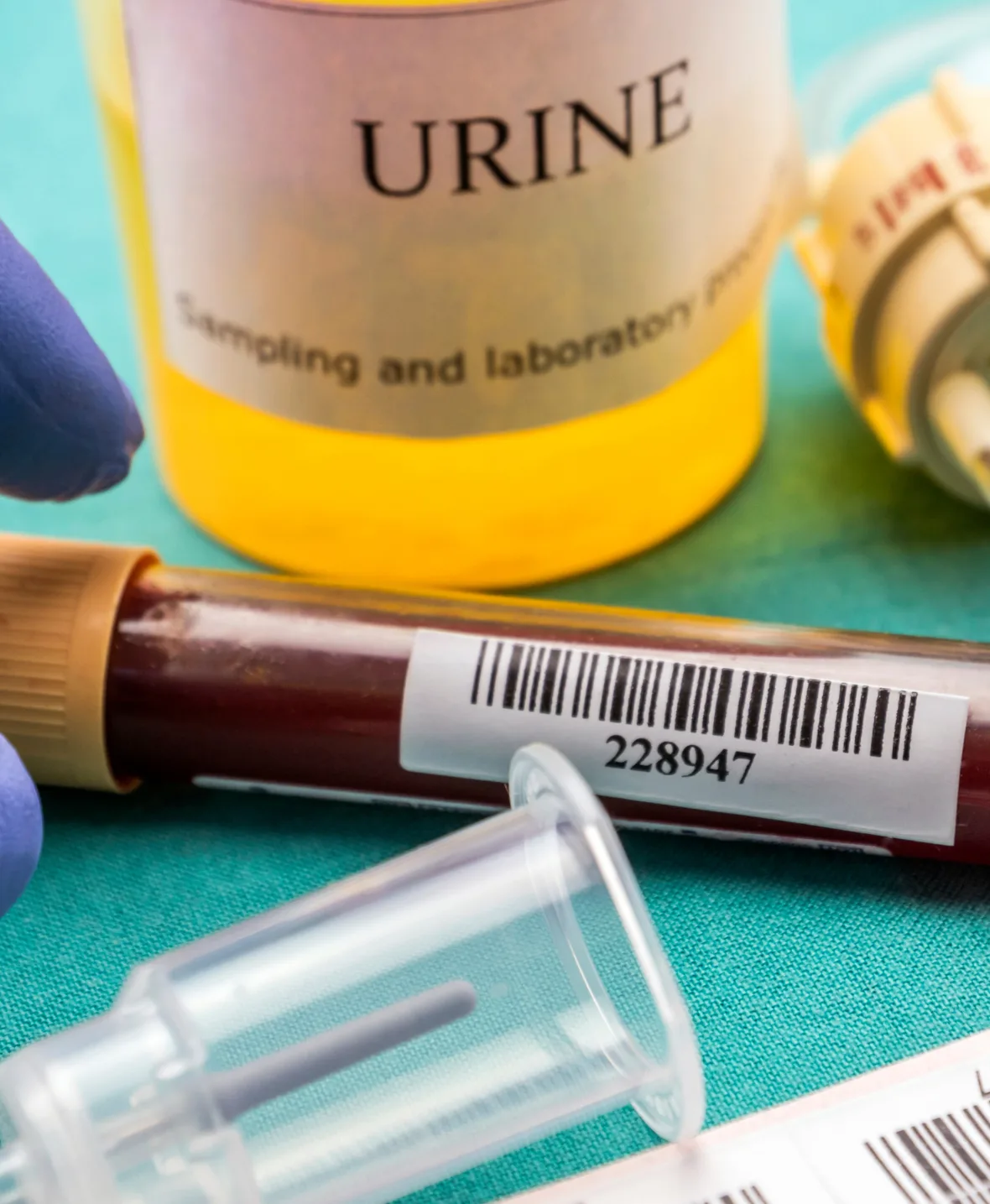 Hematuria treatment 1180x1435 img