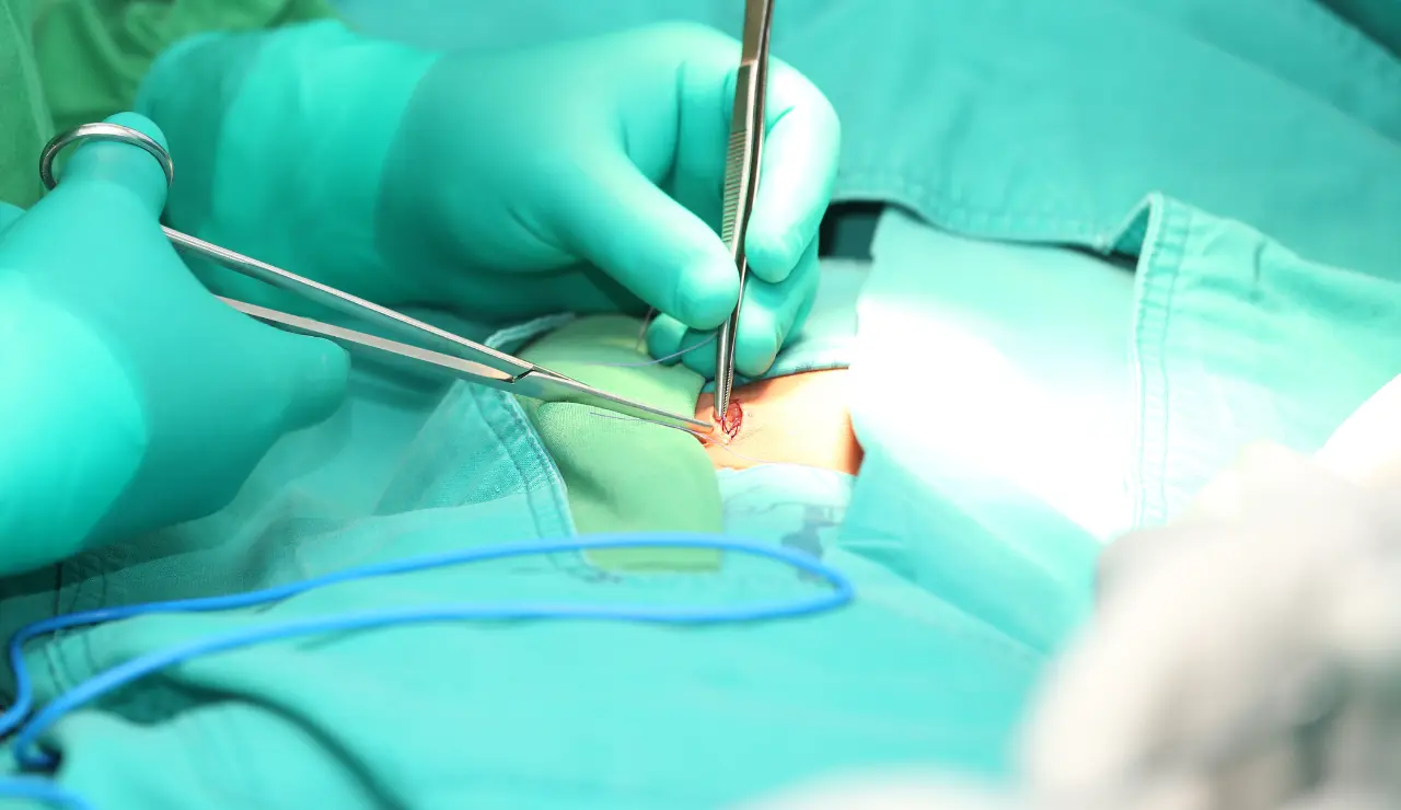 Hernia - Testimonial