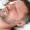 Male Facial Rejuvenation