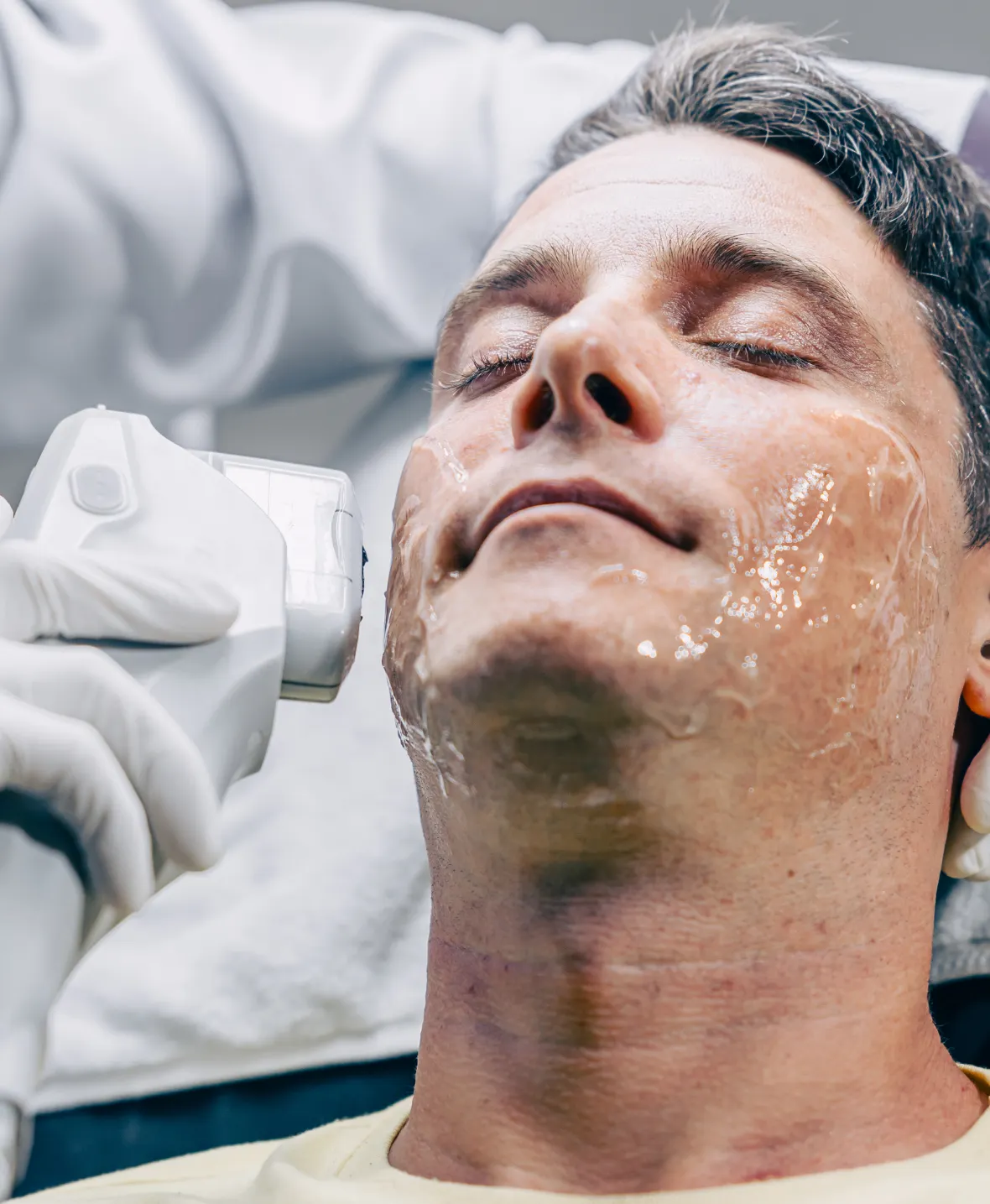 Male Facial Rejuvenation 1180x1435 img