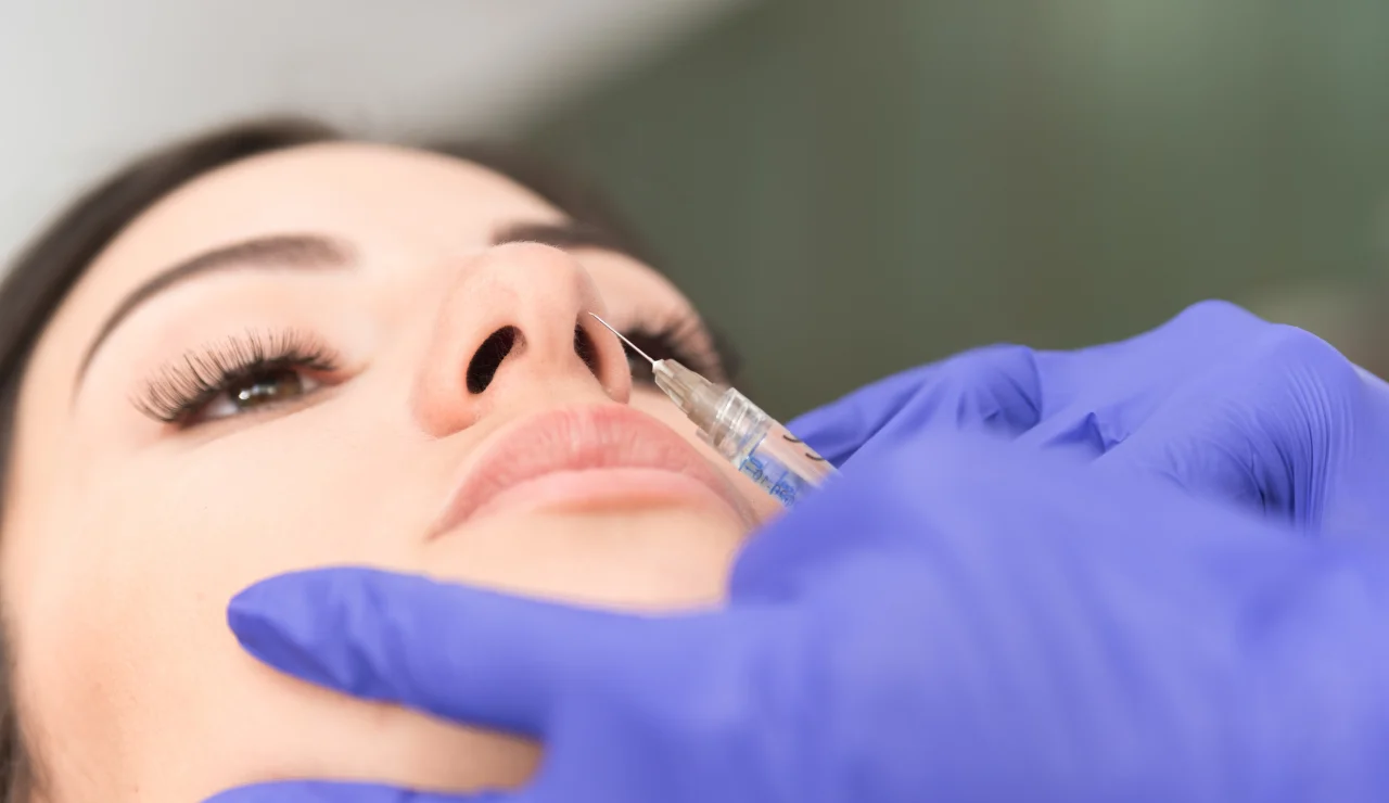 Non-Surgical Rhinoplasty - 1280x740 Testimonial