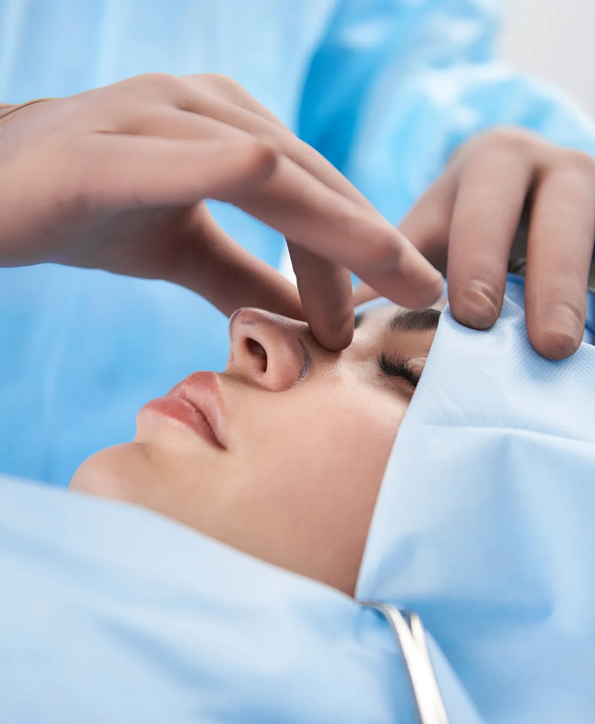 Rhinoplasty 1180x1435 img