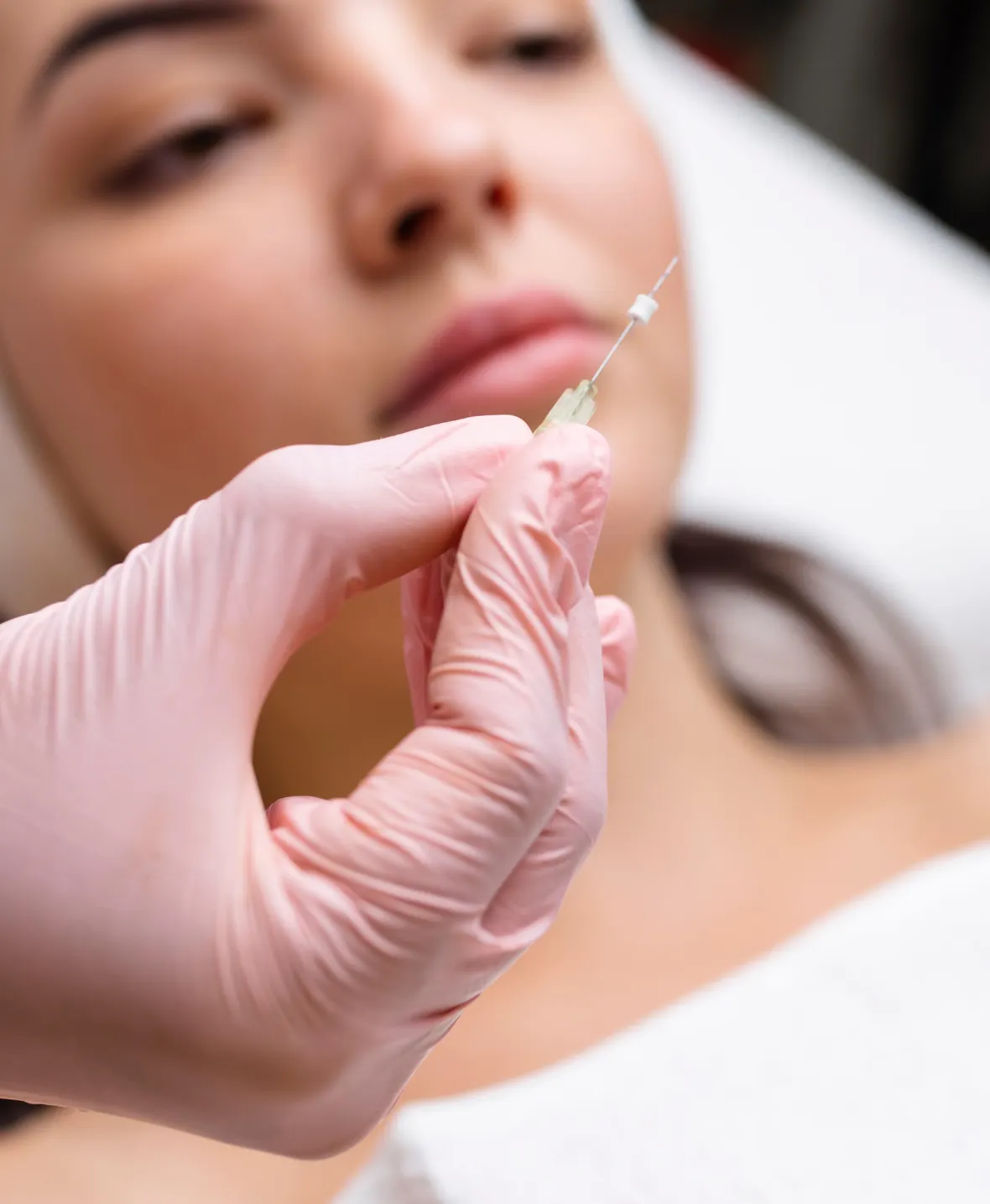 Thread Lift 1180x1435 img