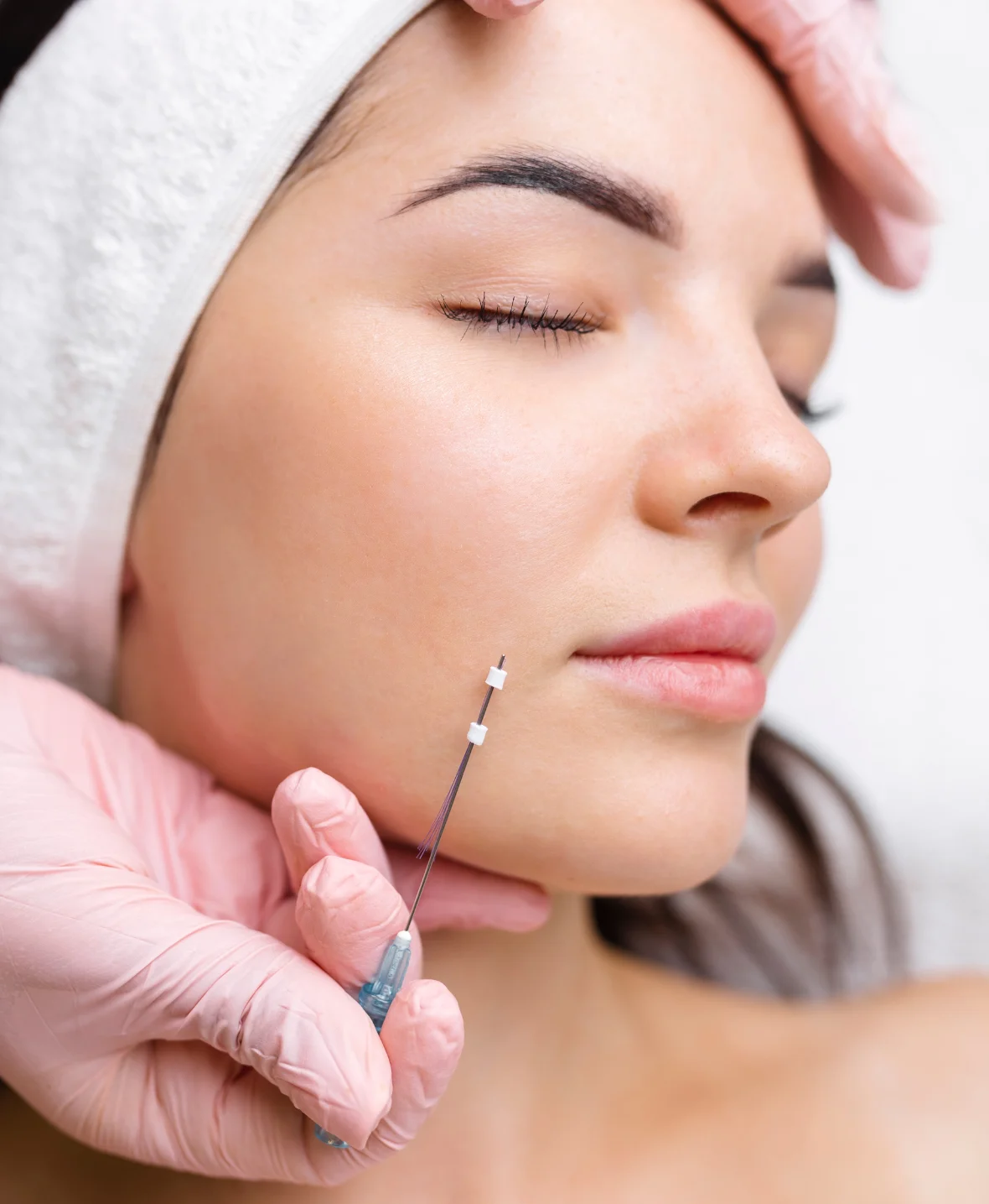 Thread Lift Procedure