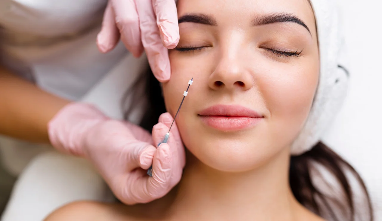 Thread Lift Procedure - Testimonial