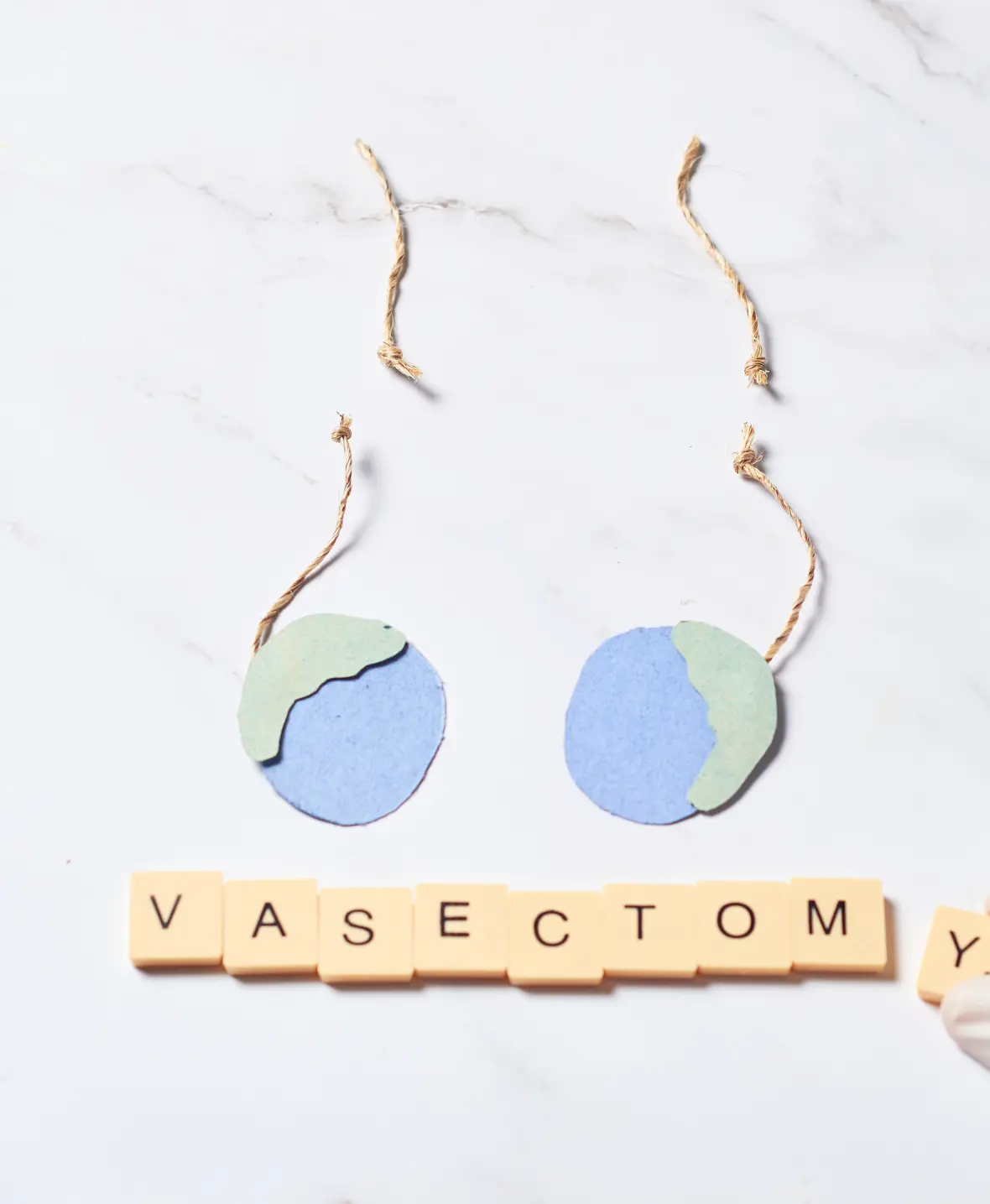 Vasectomy