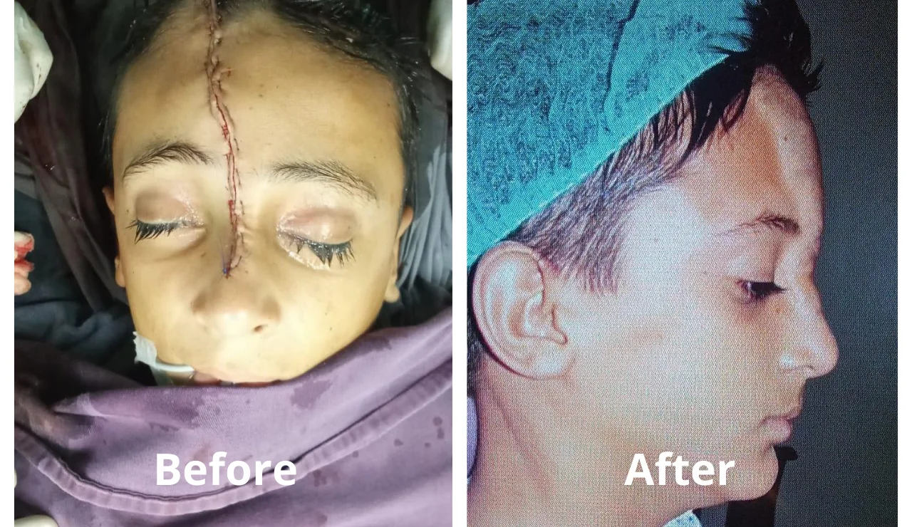 Before After img