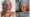Face Fat Grafting img