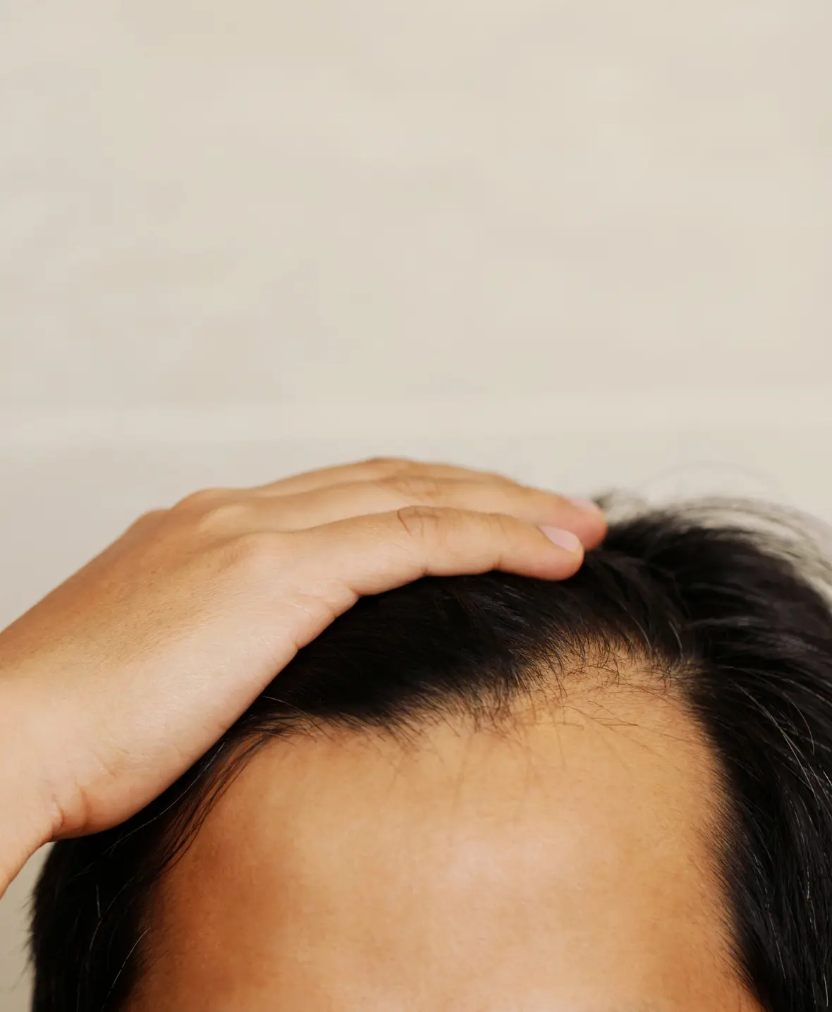 Hair Restoration Transplantation img2