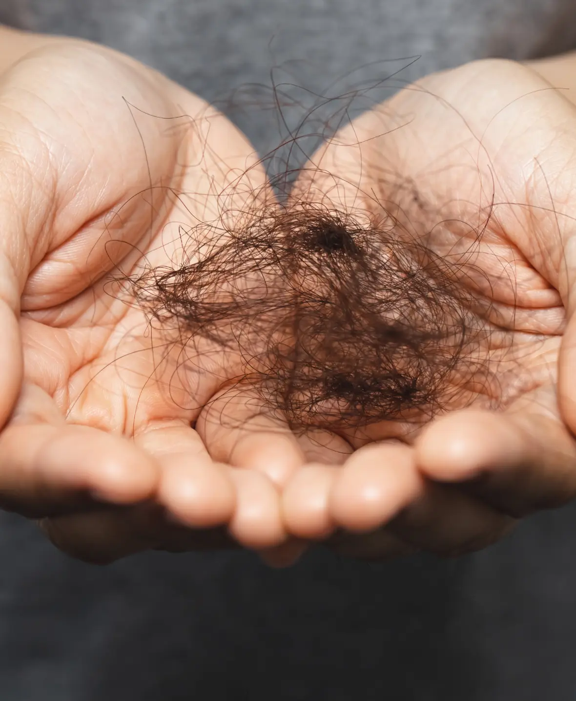 Hair loss causes img