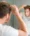 Symptoms of hair loss img
