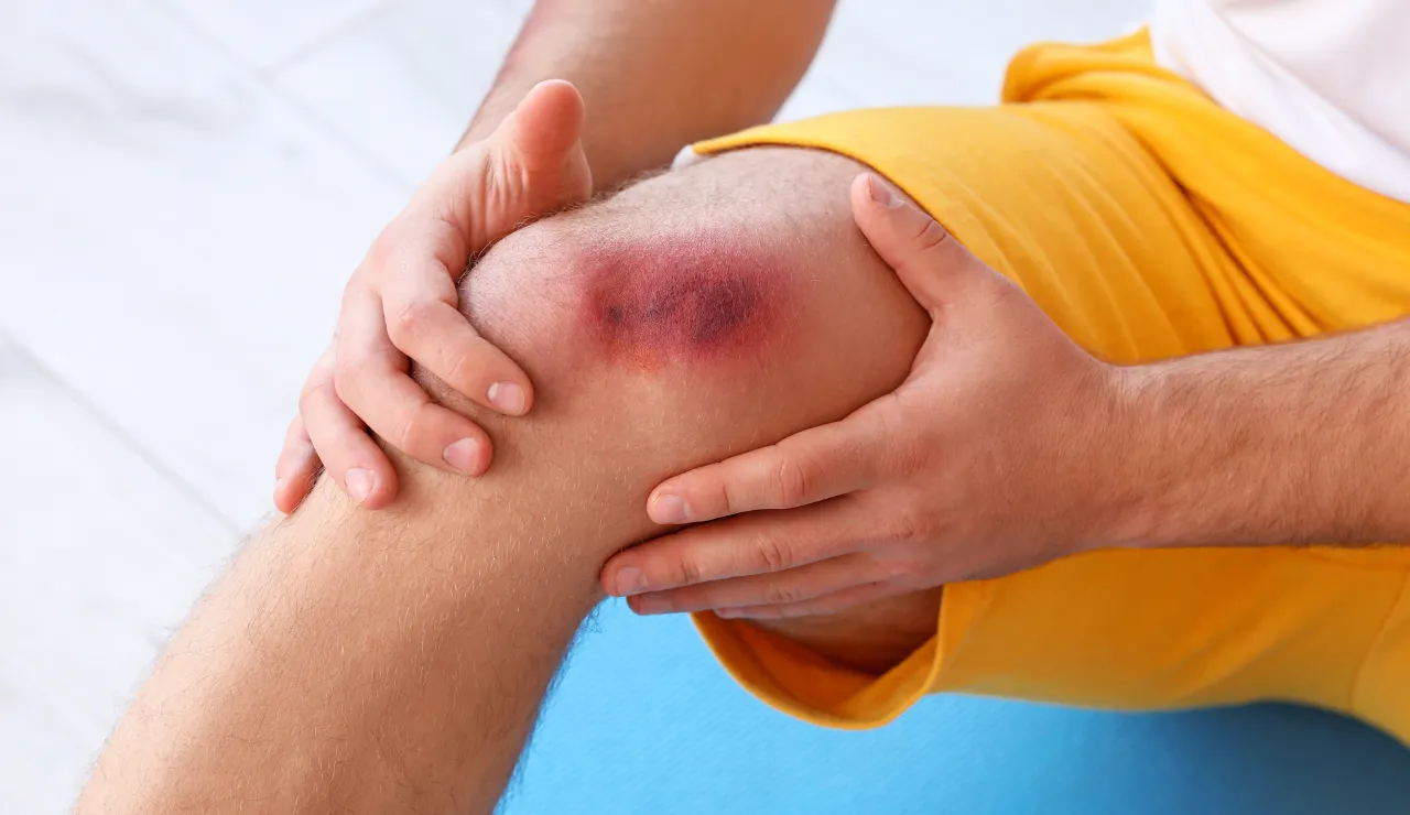 Evacuation of haematoma testimonial img2