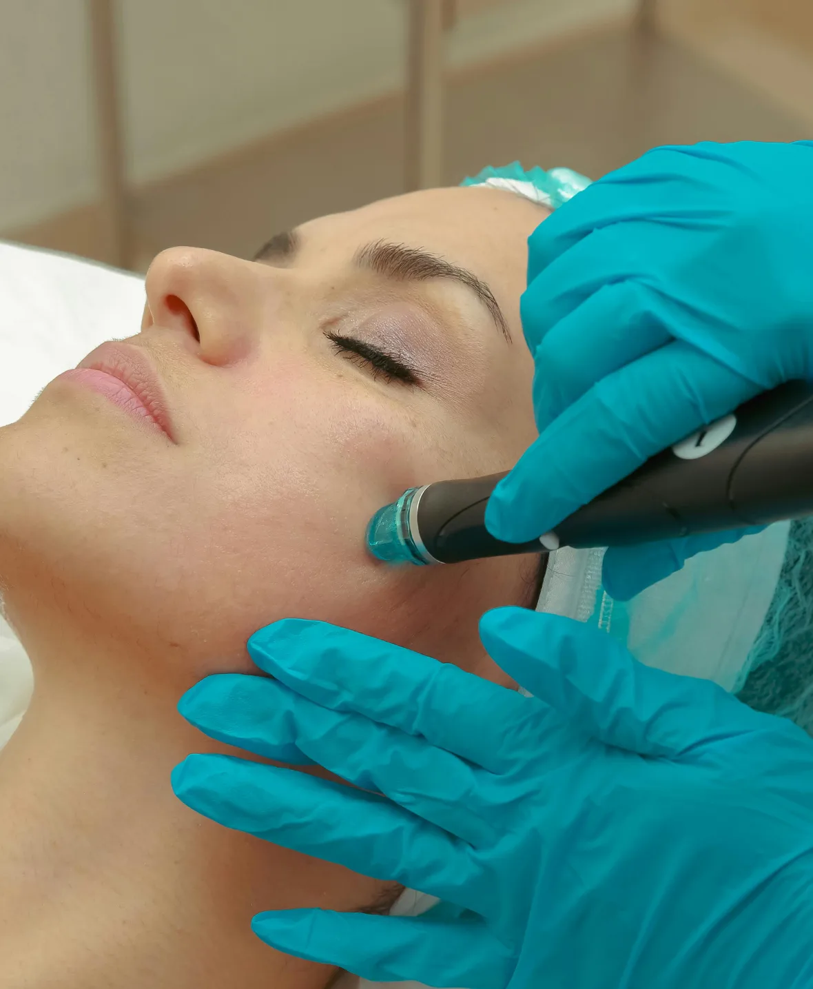 Female Facial Rejuvenation img1