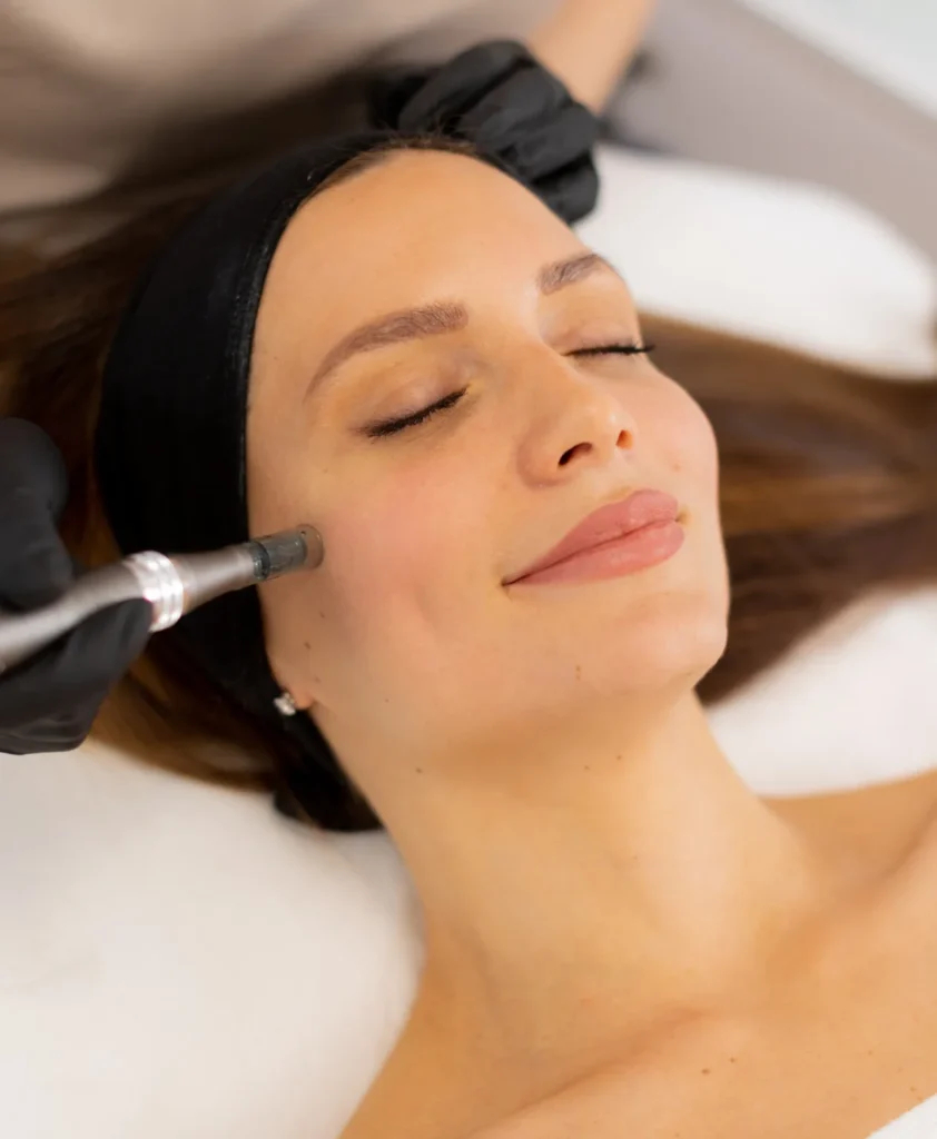 Female Facial Rejuvenation img2